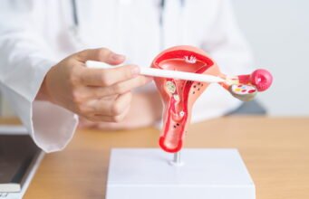 PCOS trở thành PMS: gọi tên chính xác nguyên nhân đầu tiên gây vô sinh nữ để điều trị tốt hơn