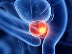 Sức khỏe. Căn bệnh ung thư tuyến tiền liệt nguy hiểm mà người dẫn chương trình truyền hình Jeremy Clarkson mắc phải là gì?