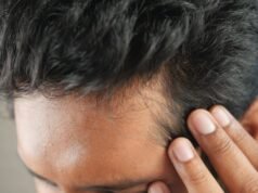 10 năm sau, Yohan không hối hận khi cấy tóc