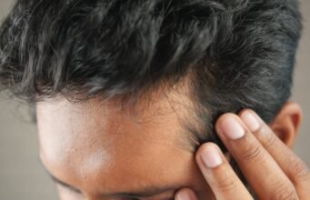 10 năm sau, Yohan không hối hận khi cấy tóc