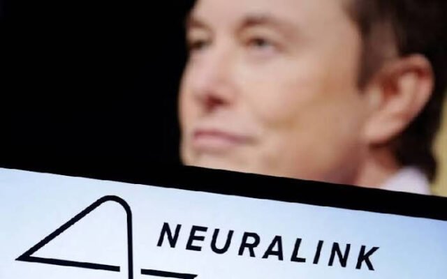 Con chip của Elon Musk có thể thực hiện những