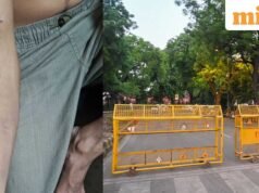 Cuộc biểu tình của CJP: một người biểu tình khác tuyên bố đã bị thương do đạn và tuyên bố “Tôi tưởng mình sắp bị mất cánh tay”