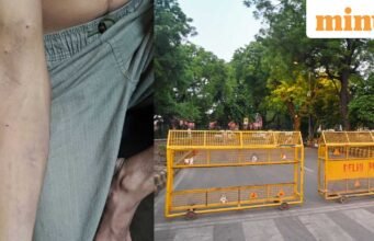 Cuộc biểu tình của CJP: một người biểu tình khác tuyên bố đã bị thương do đạn và tuyên bố “Tôi tưởng mình sắp bị mất cánh tay”