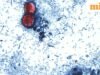 Ký sinh trùng Cyclospora lây lan ở 34 tiểu bang của Hoa Kỳ: Tại sao các ca bệnh gia tăng và loại thực phẩm nào đang được điều tra?