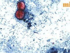 Ký sinh trùng Cyclospora lây lan ở 34 tiểu bang của Hoa Kỳ: Tại sao các ca bệnh gia tăng và loại thực phẩm nào đang được điều tra?