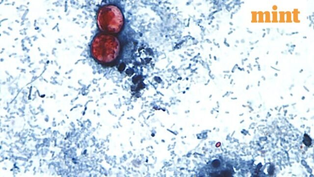 Ký sinh trùng Cyclospora lây lan ở 34 tiểu bang